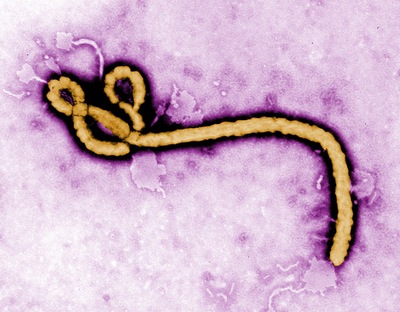 אבולה