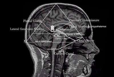 מבנה המוח